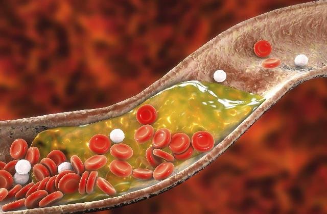 Cholesterol will be reduced, eating these 5 things will remove the dirt accumulated in the blood
