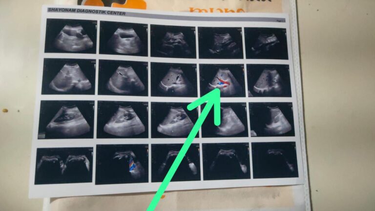 IMG_20240226_182714_462