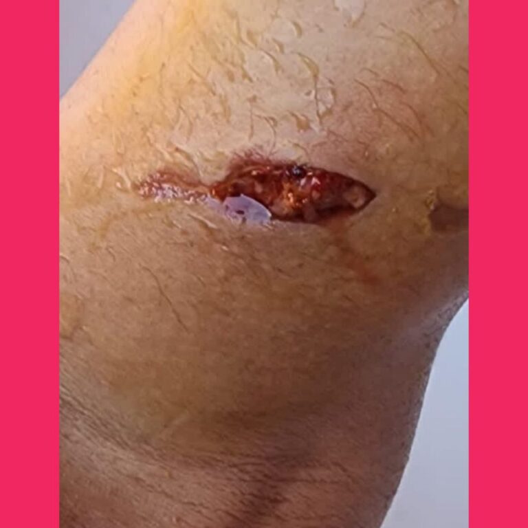 IMG_20250308_175104_057