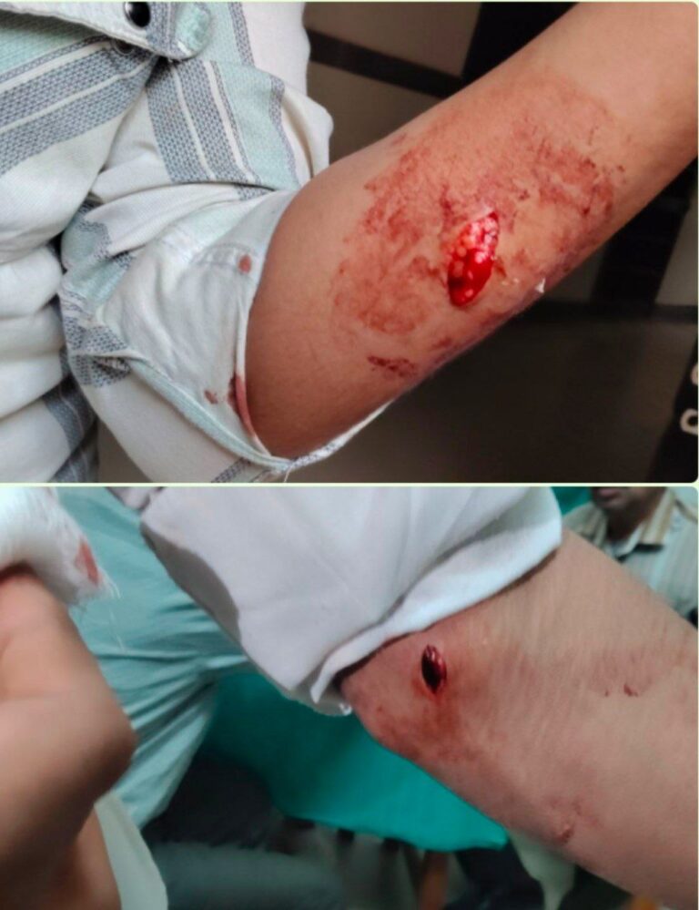 photo_6084374955442244379_y